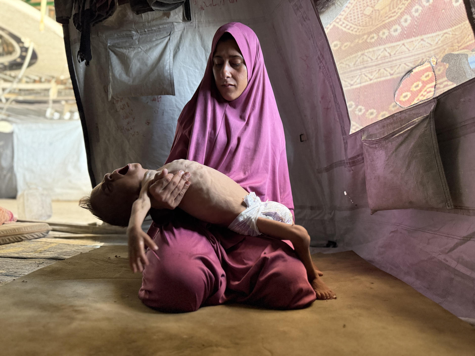 ONG en Gaza aseguran que todos los niños malnutridos morirán si no se revierte situación