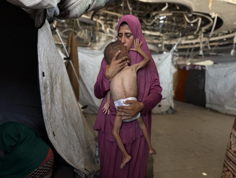 El desamparo de una madre gazatí viuda con un hijo desnutrido: "Ya no se sostiene en pie"