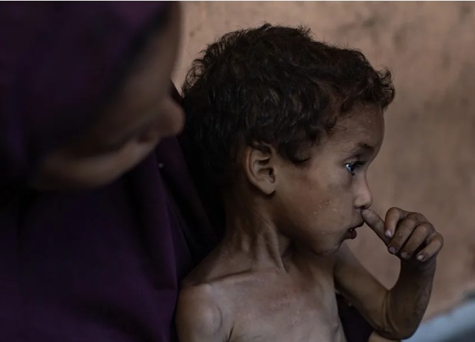 La desnutrición mata a cinco personas, incluido un bebe, en las últimas 24 horas en Gaza