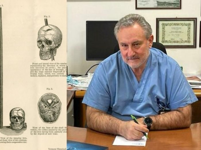 Pasó dos días en su casa con una flecha clavada en la cabeza y vivió para contarlo