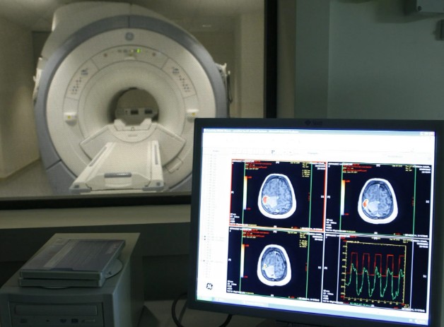 Quienes padecen trastornos intestinales tienen el doble de probabilidad de tener alzhéimer