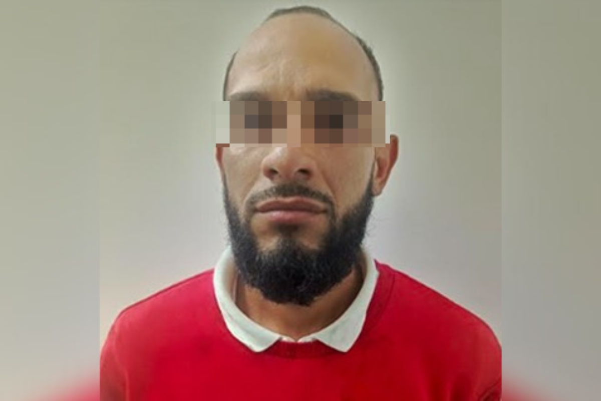 Le pusieron los ganchos por morder en el rostro a su expareja en La Vega