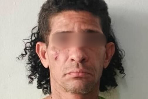 Las graves agresiones de un hombre contra su pareja en Aragua tras dejarse llevar por los celos