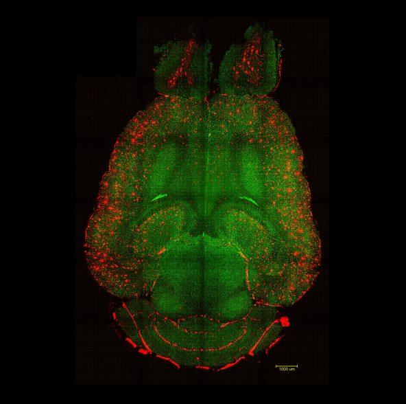 Científicos revierten el alzhéimer en ratones mediante nanopartículas