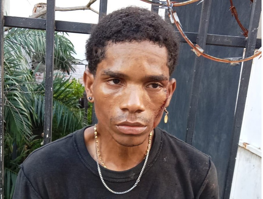 Venezolano murió en medio de una pelea entre indigentes en Colombia