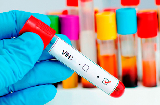 Autoridades sanitarias registraron un alarmante aumento de VIH y sida en pueblos indígenas de Perú