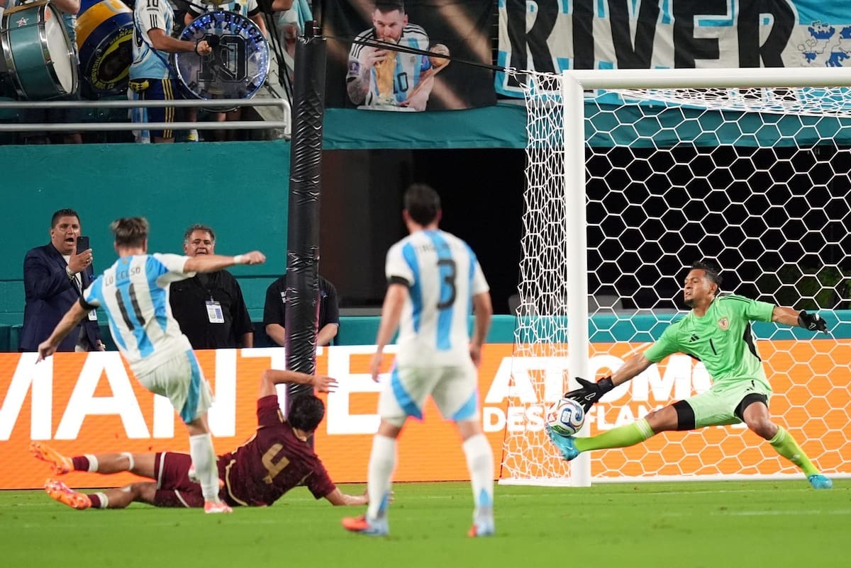 Contreras fue un gigante, pero no pudo evitar la caída de la Vinotinto frente a Argentina