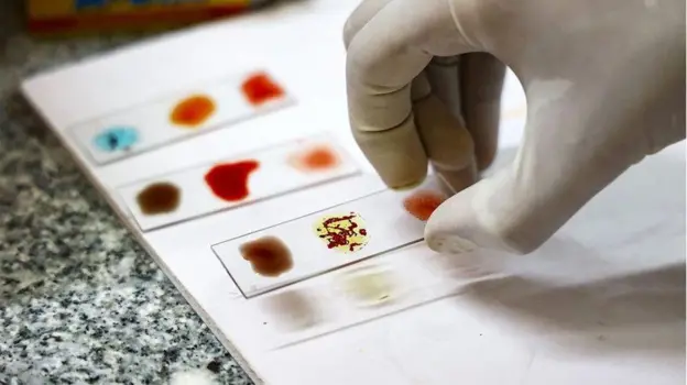 "Sangre dorada": por qué los científicos están intentando cultivar la sangre más rara del mundo en un laboratorio