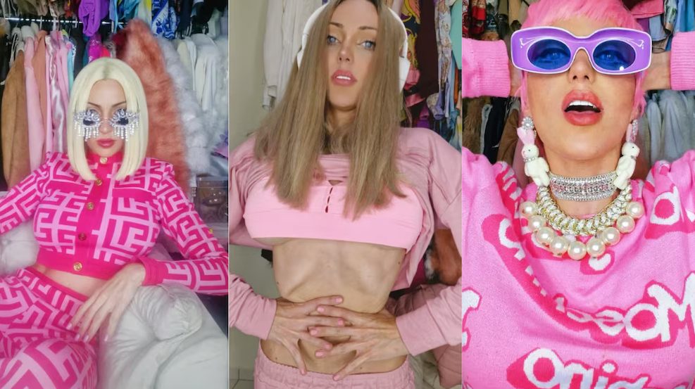 La historia y retoques de la "Barbie humana" que murió tras un encuentro íntimo en Brasil