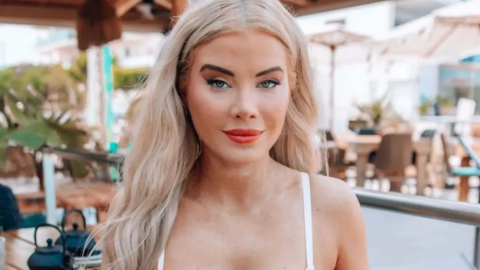 El terror de una joven que viajó miles de kilómetros para una cirugía estética y fue acosada al recuperarse en el hospital