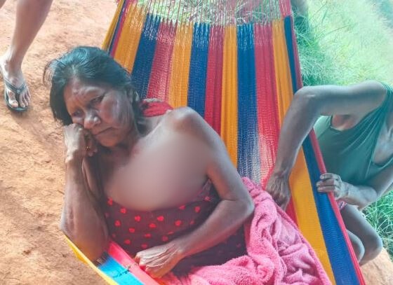 Epidemias y abandono médico afectan a niños y personas mayores en comunidad indígena de Bolívar