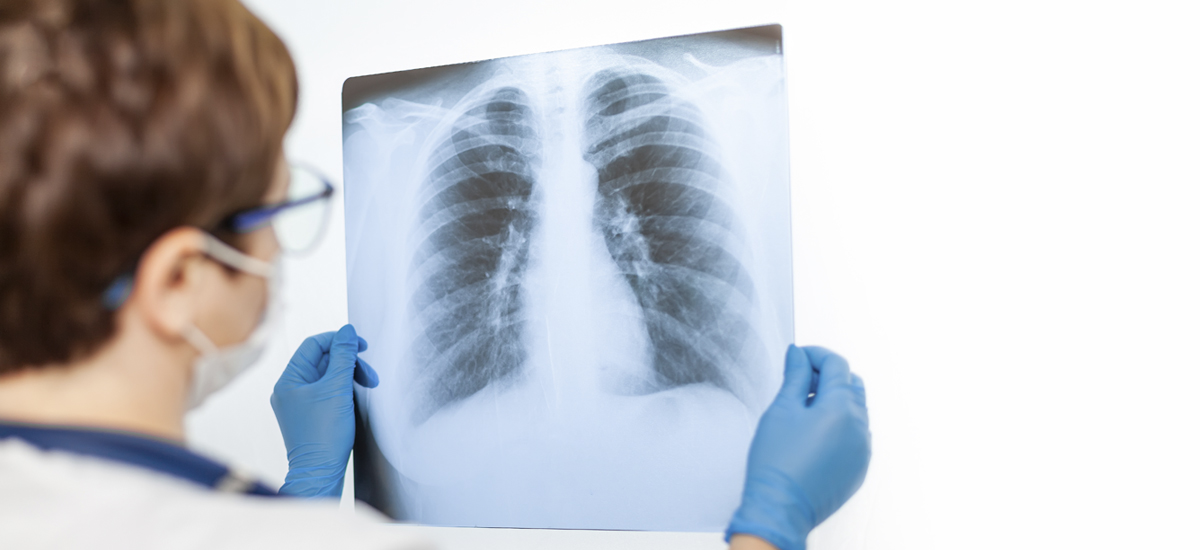 OMS alertó que pérdida de confianza en vacunas aumentará casos de neumonía y meningitis