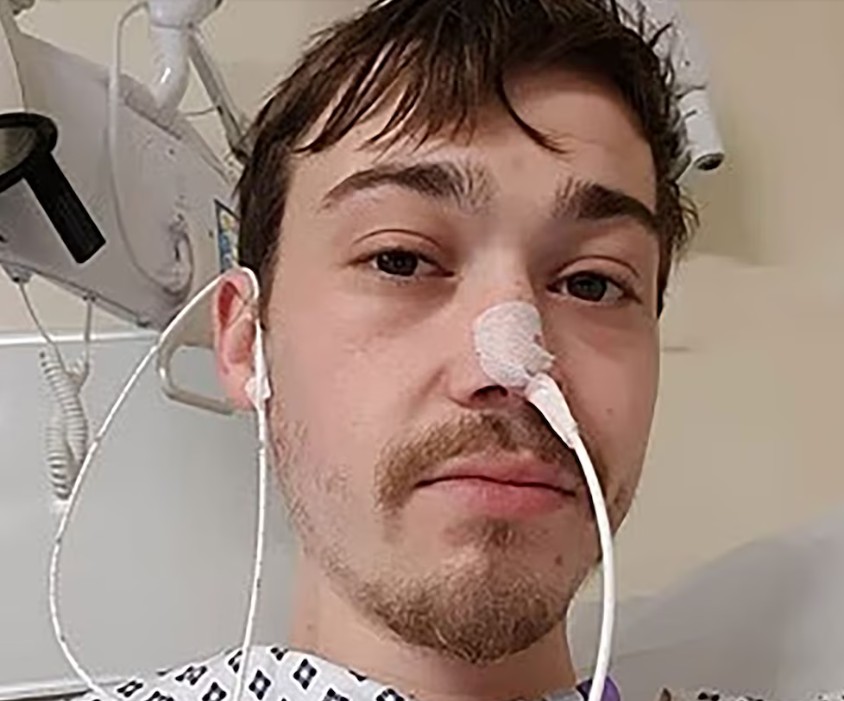 La historia del hombre que vomita 60 veces al día por una extraña enfermedad