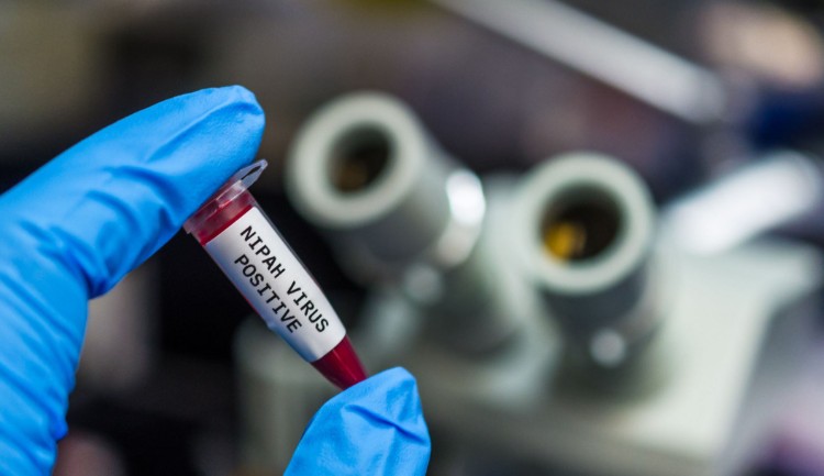 China no ha registrado casos de virus Nipah y evalúa como bajo el riesgo para el país