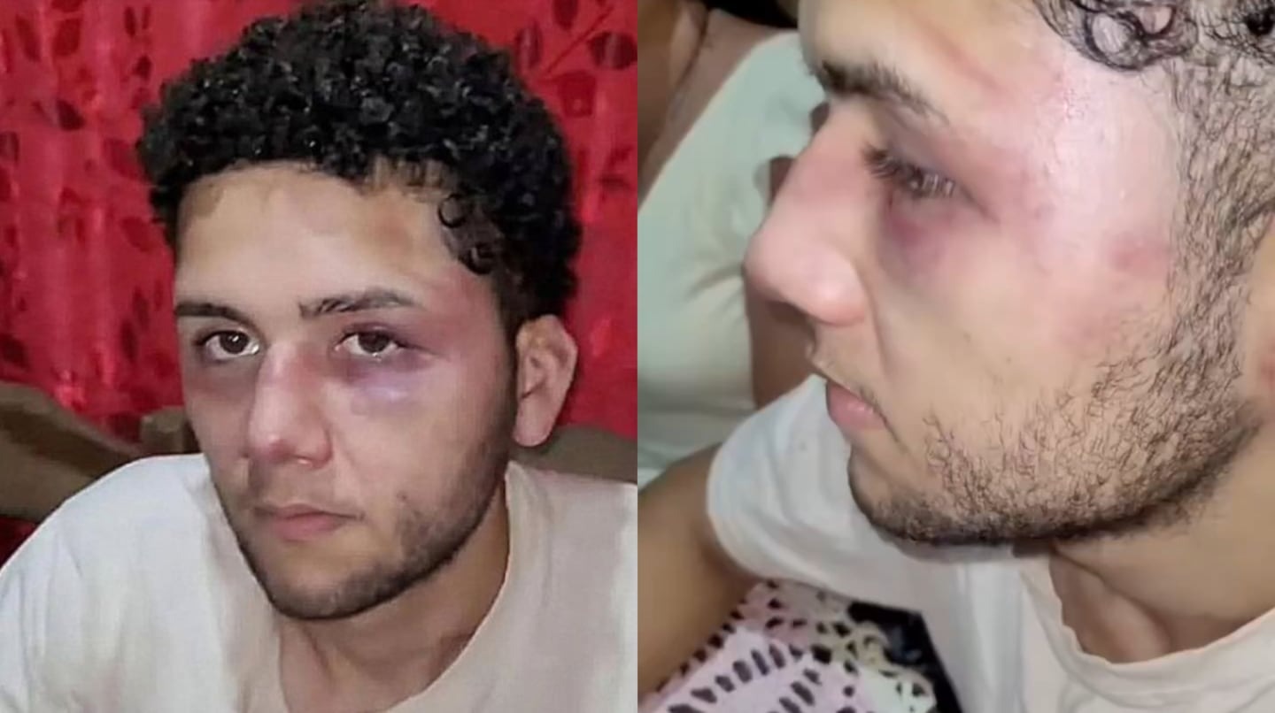 Denunció que sus jefes lo secuestraron, lo torturaron y lo amenazaron para que renunciara