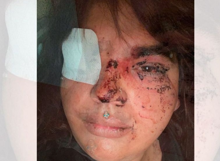 Una mujer transexual golpeada e insultada en España por un grupo de personas