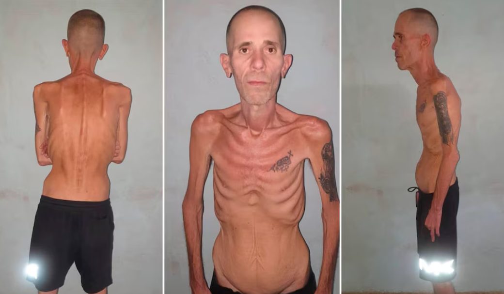 EXCARCELACIÓN PRISIONERO POLÍTICO CUBANO: DETERIORO FÍSICO Y ACUSACIONES DE MALTRATO