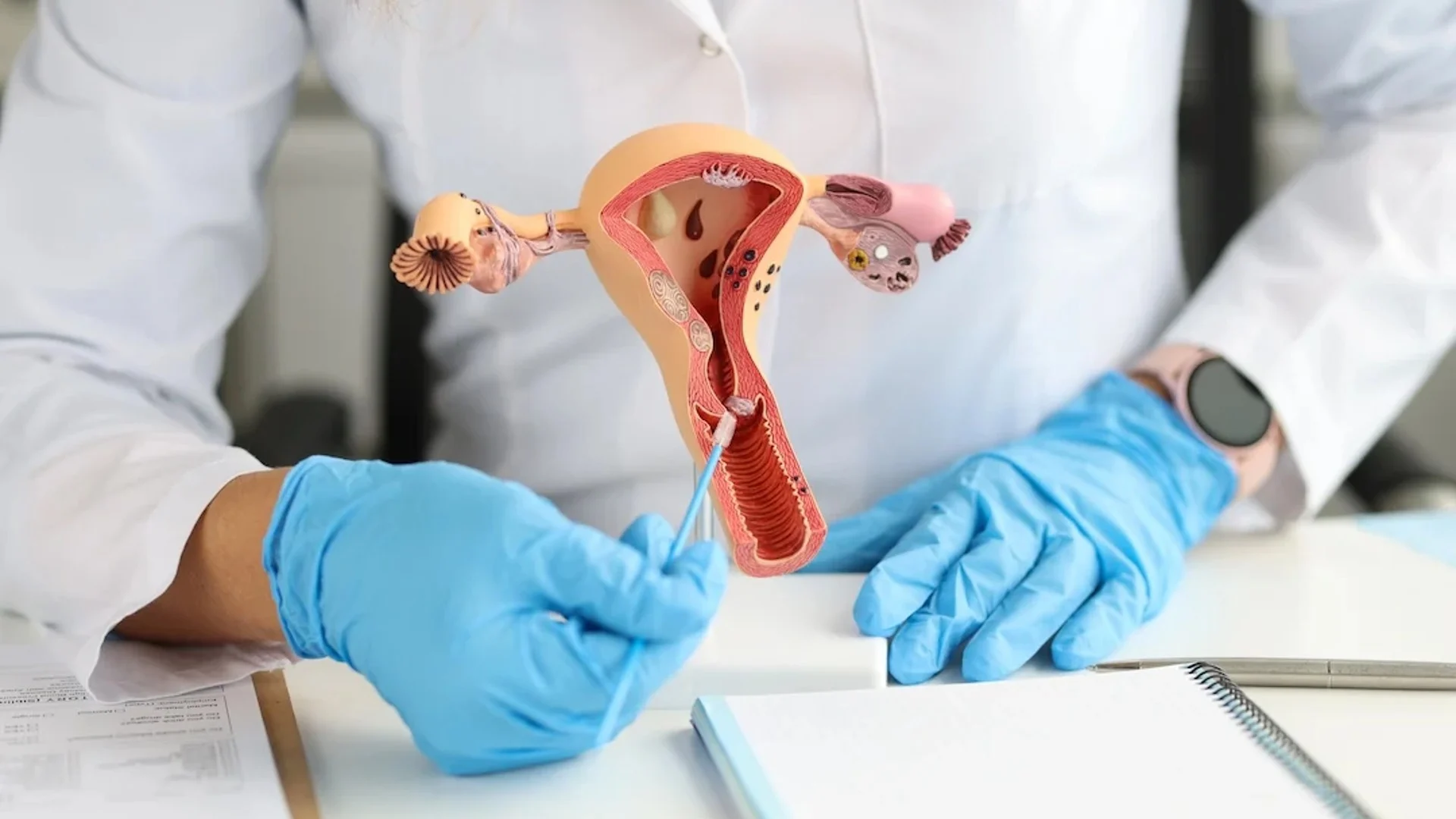 Cáncer de cuello uterino es la segunda causa de muerte oncológica en mujeres, según expertos