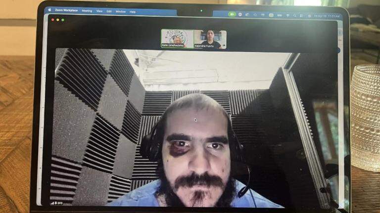 Denuncian golpizas y gas pimienta contra detenidos de Alligator Alcatraz tras protesta por teléfonos