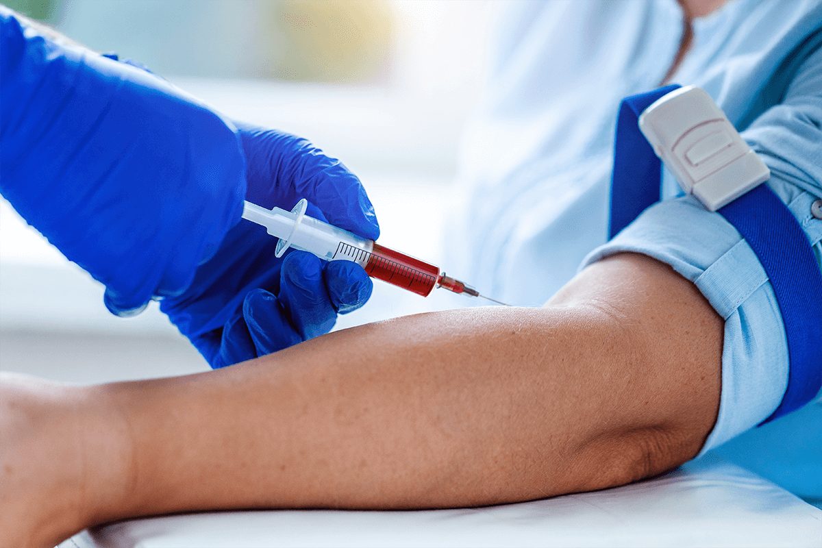 Prueba de sangre para detectar el cáncer a tiempo muestra resultados prometedores