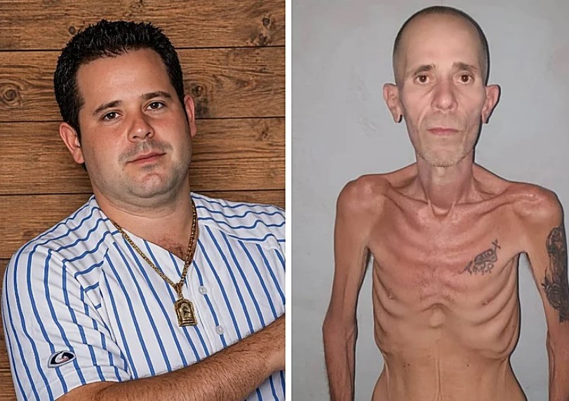 Unos 90 mil presos en Cuba están expuestos a daños por desnutrición, según ONG