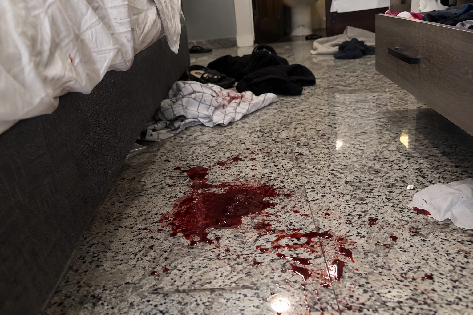 Joven de 20 años murió tras varios días de agonía por un disparo de su pareja en Catia