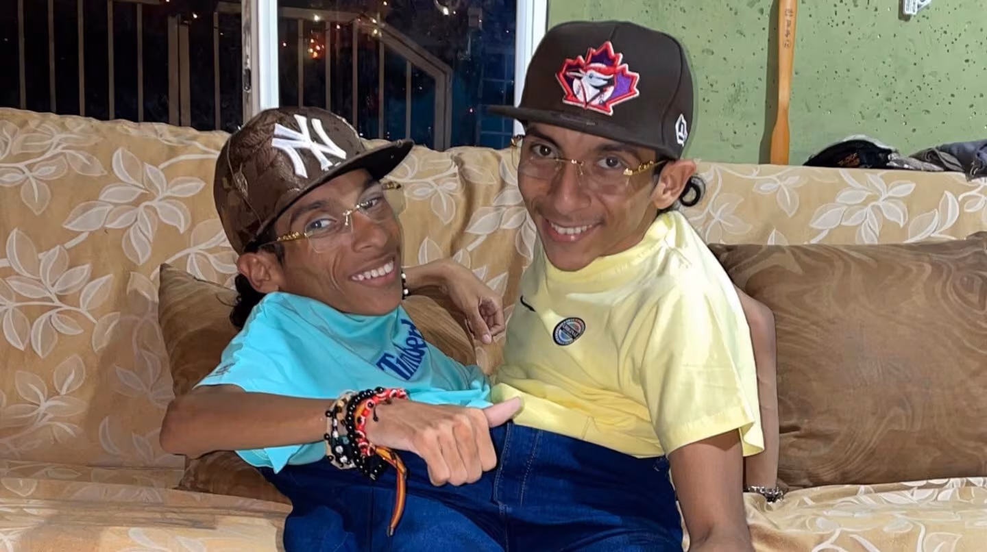 Murieron los hermanos siameses ecuatorianos que viajaron a Colombia para intentar cumplir su sueño